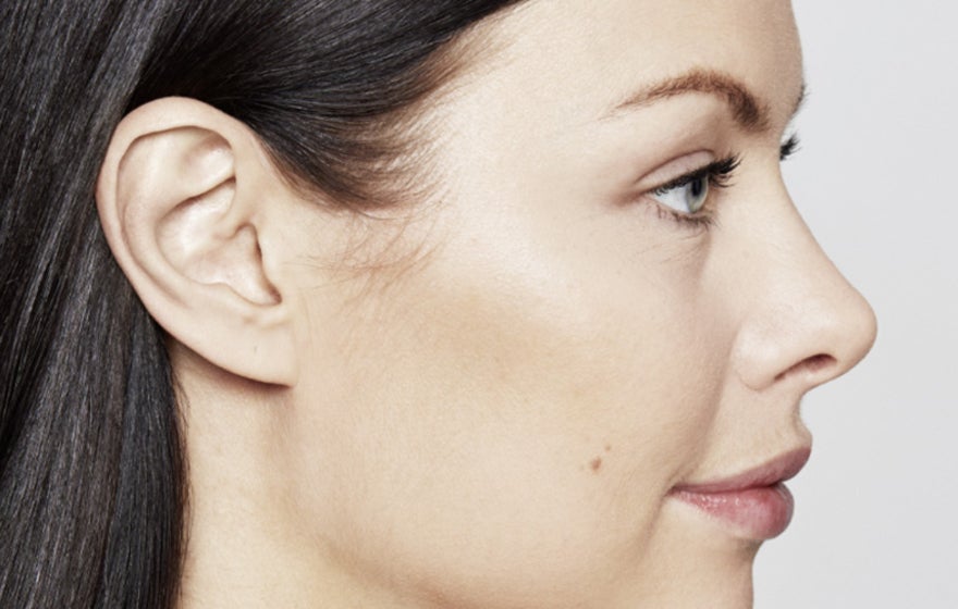 Restylane®Kysse™ – en läppfiller som får din partner att vilja kyssa dig mer