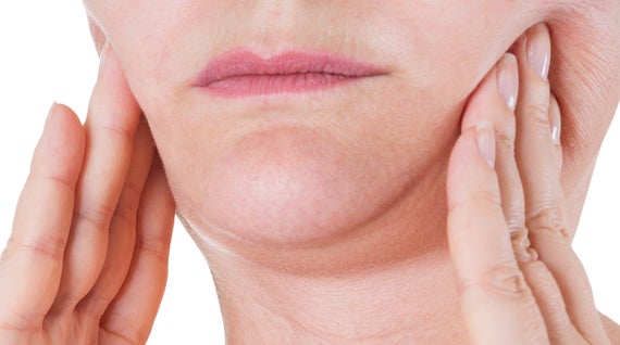 Sculptra-behandling