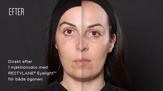 SÄG HEJDÅ TILL TRÖTTA ÖGON OCH FÅ ETT PIGGARE UTSEENDE MED RESTYLANE® EYELIGHT™