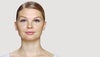 Se resultat efter injektion med Restylane-fillers